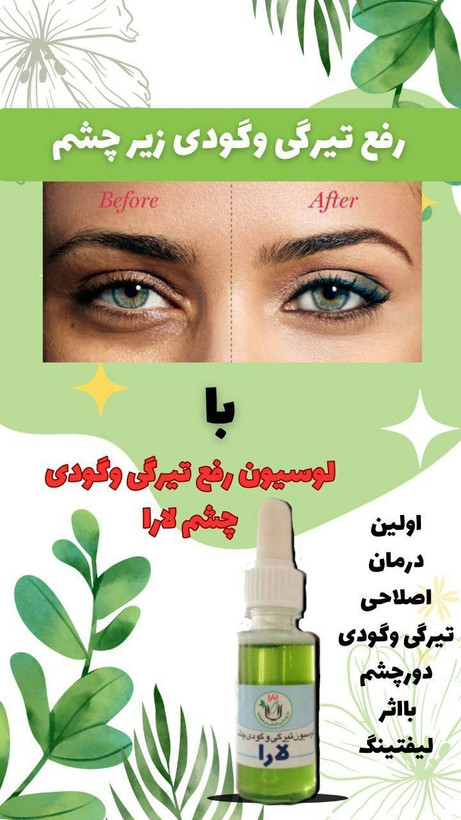 لوسیون رفع تیرگی و گودی زیر چشم (صددرصد اصلی)جوابدهی عالی