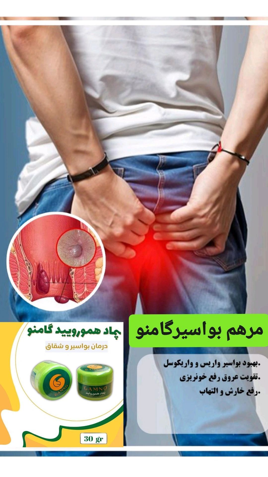 پماد درمان هموروئید