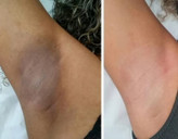 کرم دست ساز دکتر طب سنتی ضدلک و روشن کننده فوق قوی پوست سفید کننده عالی