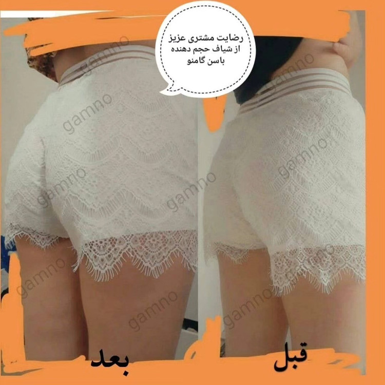 شیاف حجم دهنده باسن(نمونه صدرصد اصلی)