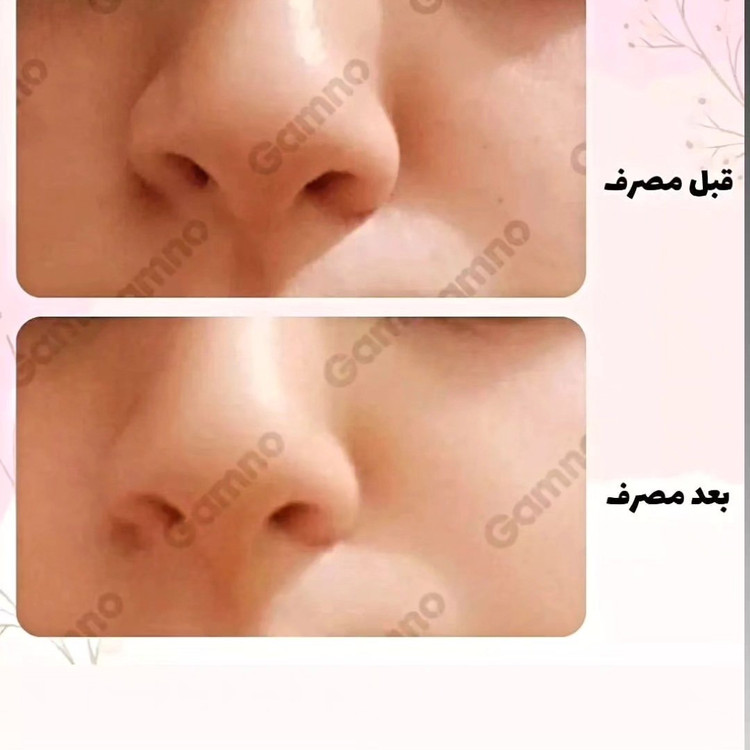 کوچک کننده بینی گام اصلی