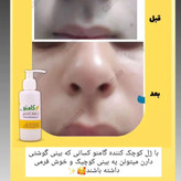 کوچک کننده بینی گام اصلی
