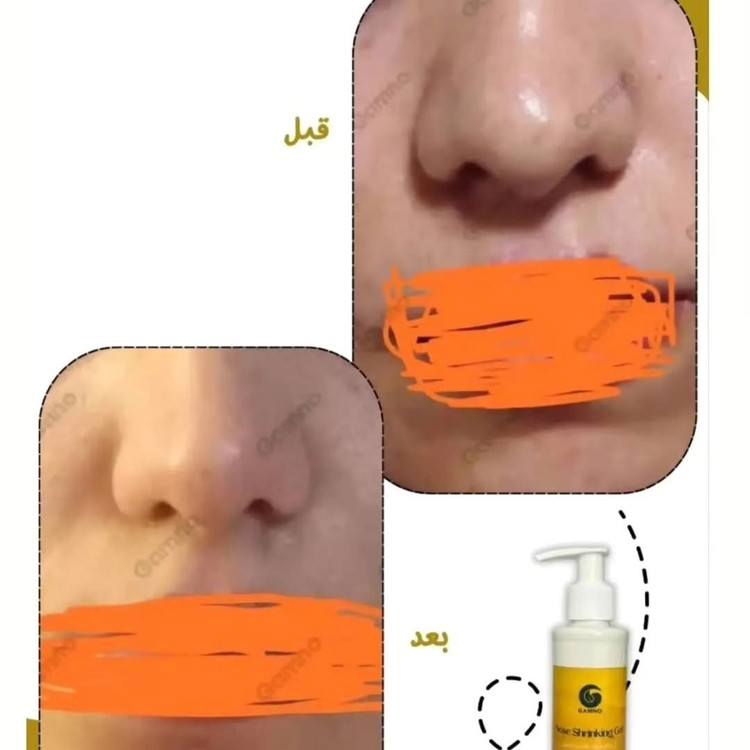 کوچک کننده بینی Go مخصوص بینی های گوشتی(جواب دهی عالی)