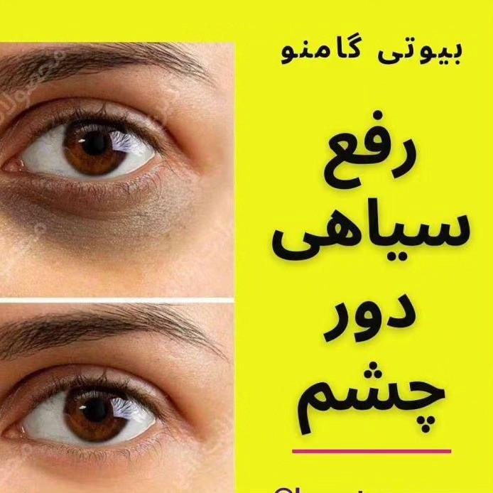کرم دور چشم گام